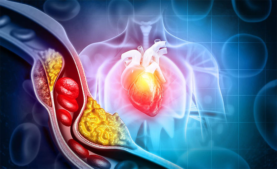 The Biggest LIES About Cholesterol